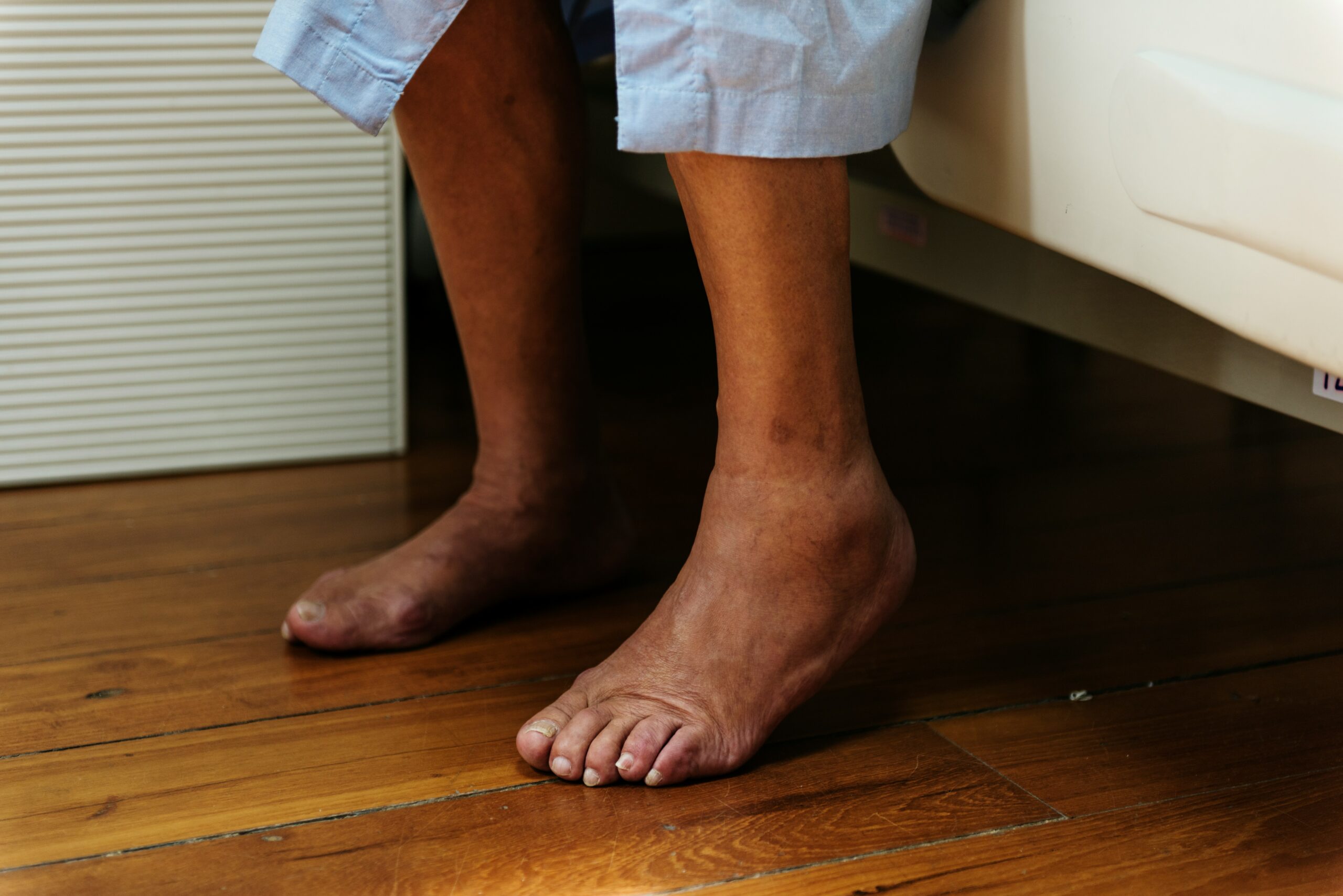 A person in blue hospital pants sits on a bed with bare feet placed on a wooden floor, showing slightly swollen ankles and visible veins—signs of foot fatigue.